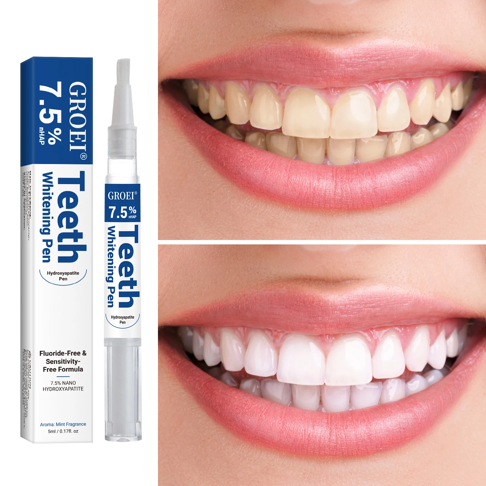 Гидроксипатитовая ручка для от – обзор и цена Teeth Whitening Before And After