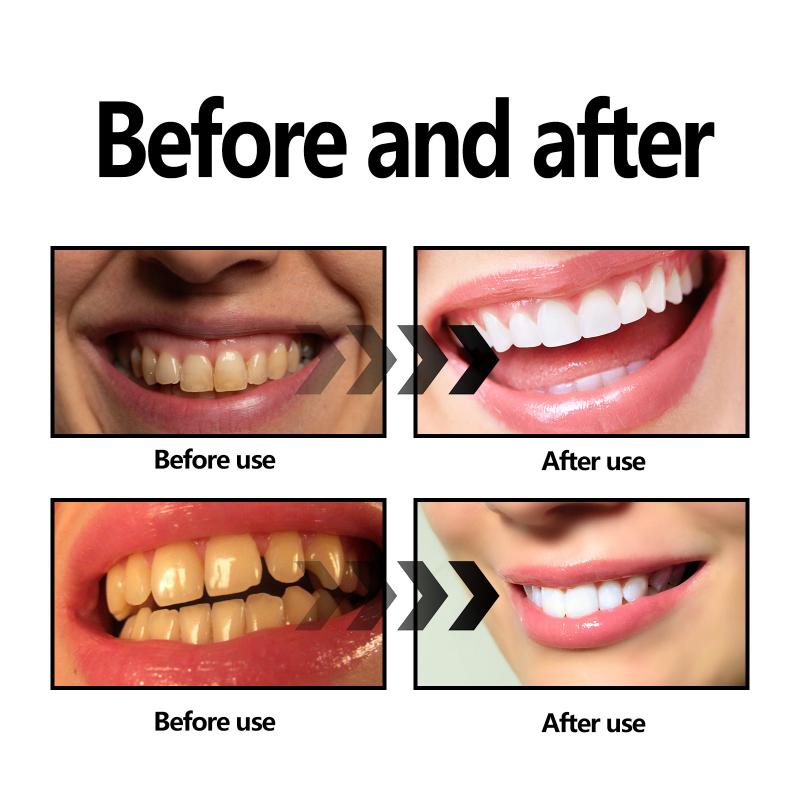 Порошок для отбеливания зубов  – обзор и цена Teeth Whitening Charcoal Powder