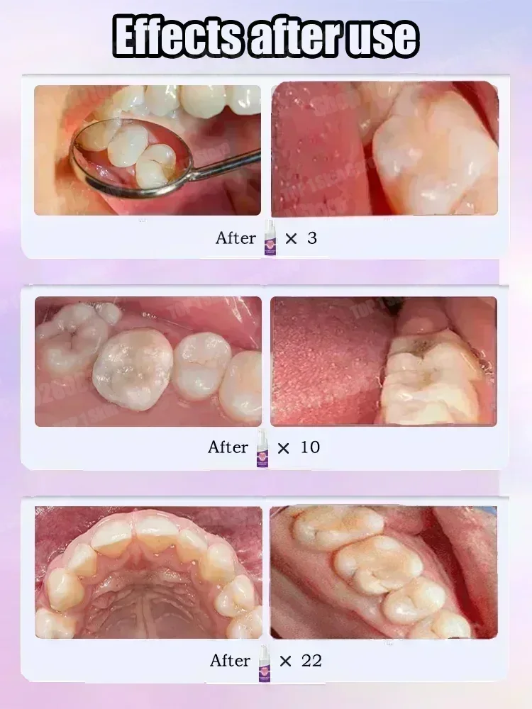 Горячие продажи. Самые продава – обзор и цена Teeth Whitening Charcoal Powder