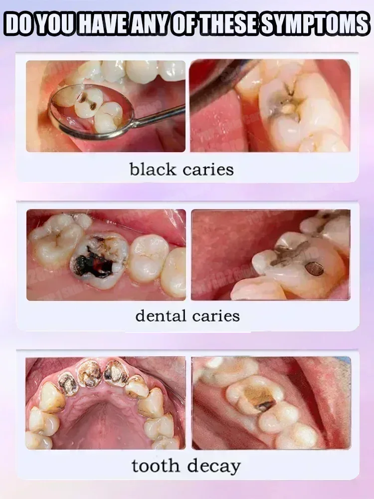 Горячие продажи. Самые продава – обзор и цена Teeth Whitening Charcoal Powder