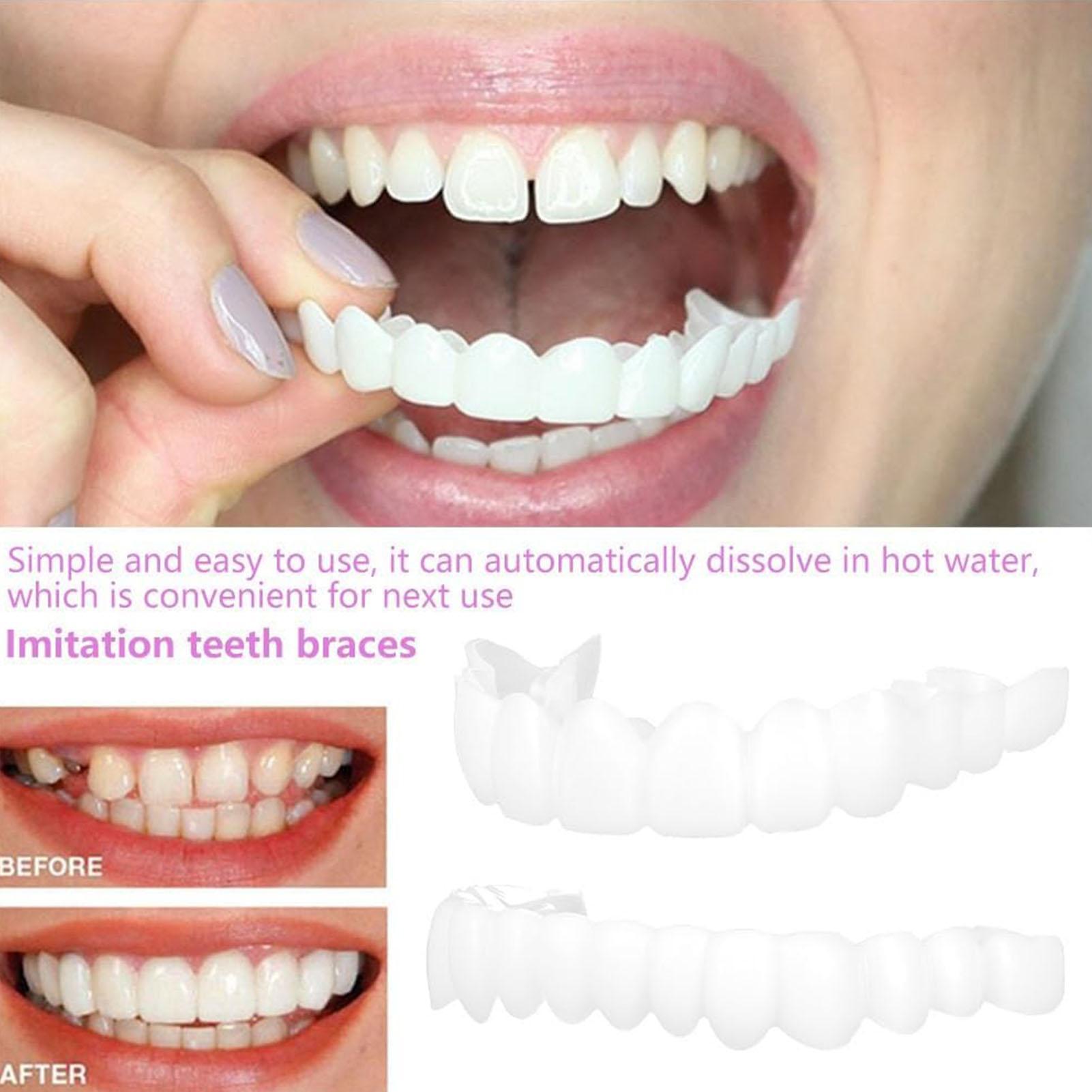 2 шт., виниры для временных зу – обзор и цена Teeth Whitening Mask