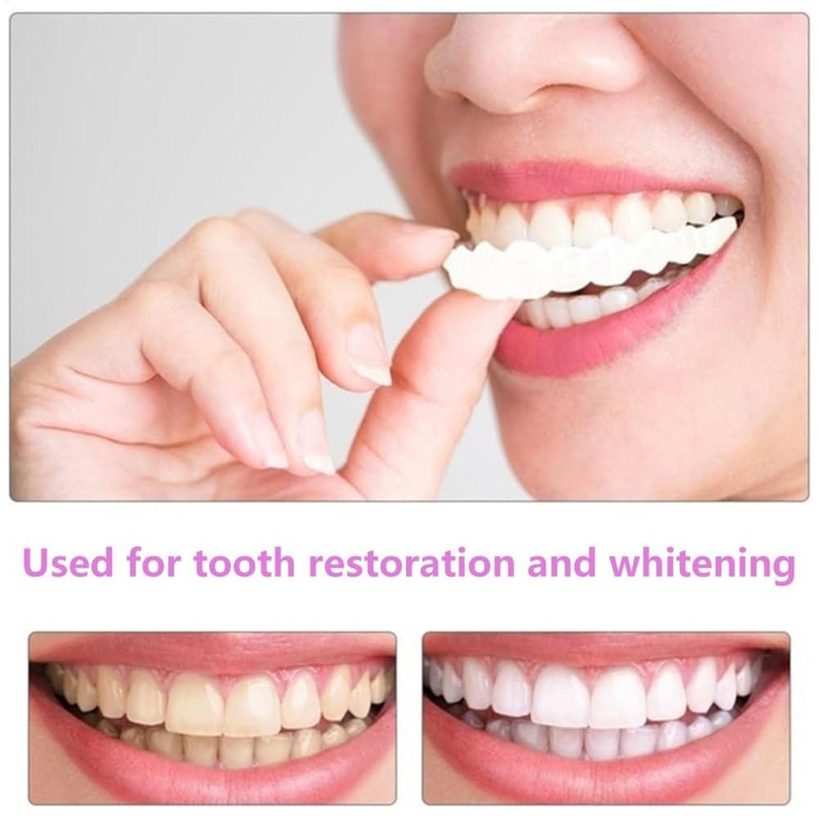 2 шт., виниры для временных зу – обзор и цена Teeth Whitening Mask