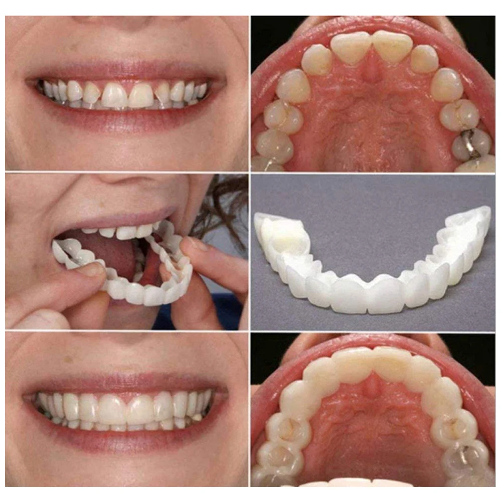 2 пары, отбеливающие протезы д – обзор и цена Teeth Whitening Mask